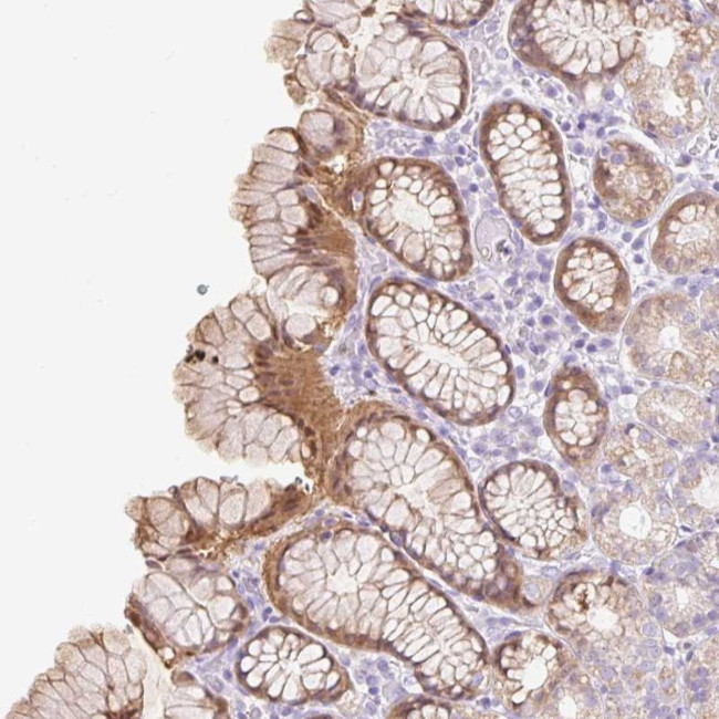 SLC25A40 Antibody in Immunohistochemistry (Paraffin) (IHC (P))