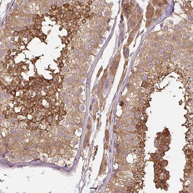C2orf73 Antibody in Immunohistochemistry (Paraffin) (IHC (P))