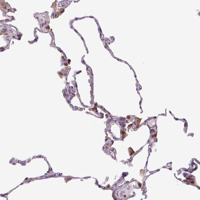 SPSB2 Antibody in Immunohistochemistry (Paraffin) (IHC (P))