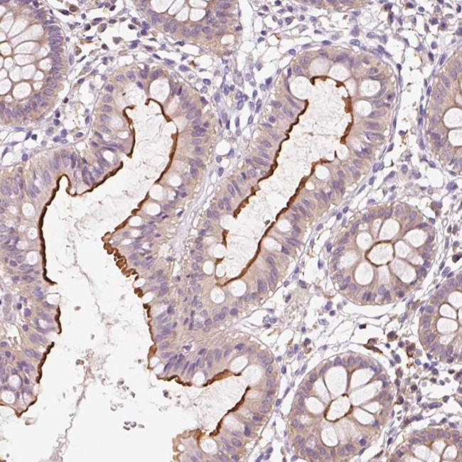 OR8K1 Antibody in Immunohistochemistry (Paraffin) (IHC (P))