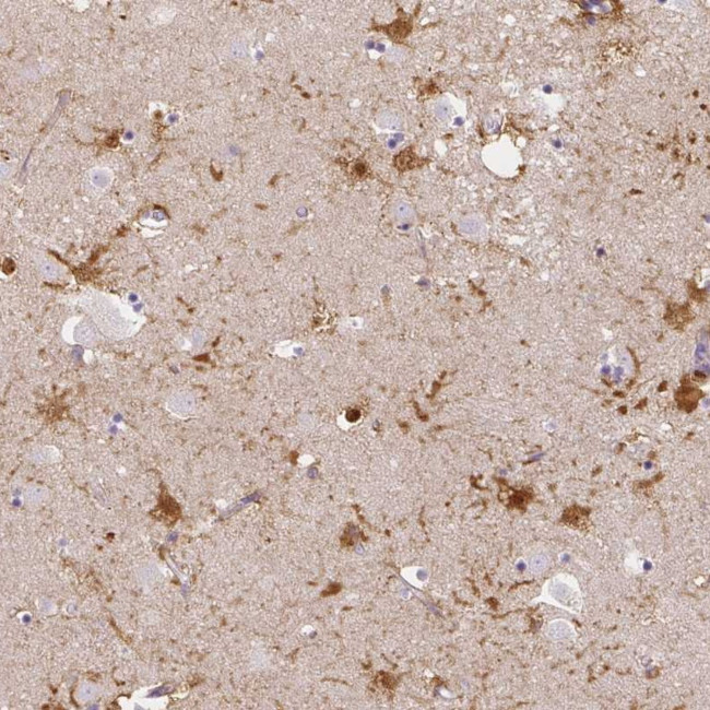 LRRC36 Antibody in Immunohistochemistry (Paraffin) (IHC (P))