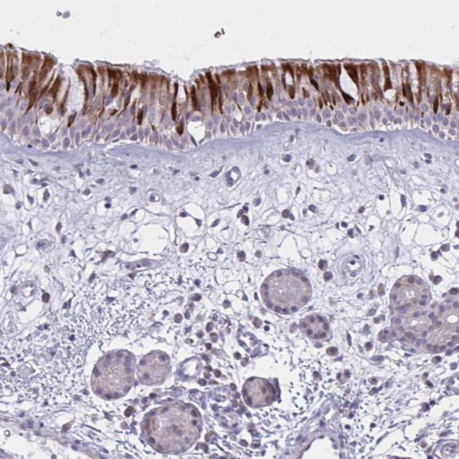 VWC2 Antibody in Immunohistochemistry (Paraffin) (IHC (P))