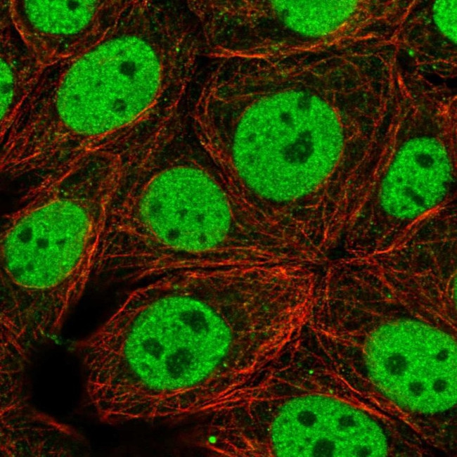 HYPK Antibody in Immunocytochemistry (ICC/IF)