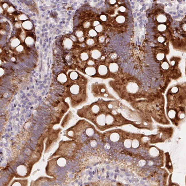 YIF1B Antibody in Immunohistochemistry (Paraffin) (IHC (P))
