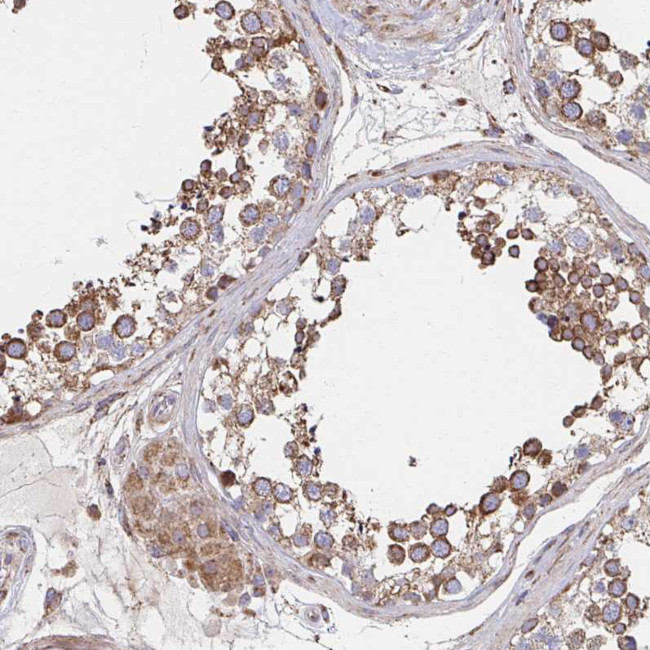 SAT1 Antibody in Immunohistochemistry (Paraffin) (IHC (P))