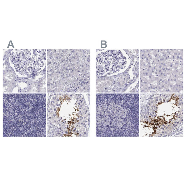 CLPH Antibody in Immunohistochemistry (IHC)