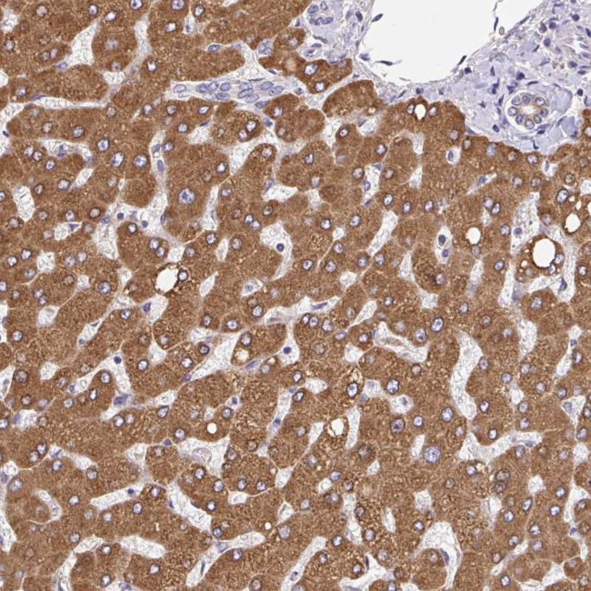 EML5 Antibody in Immunohistochemistry (Paraffin) (IHC (P))