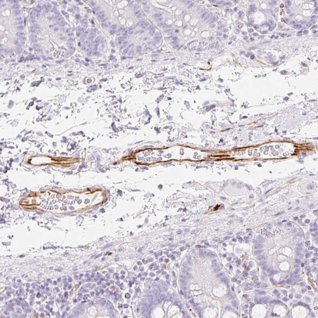 ZNF689 Antibody in Immunohistochemistry (Paraffin) (IHC (P))