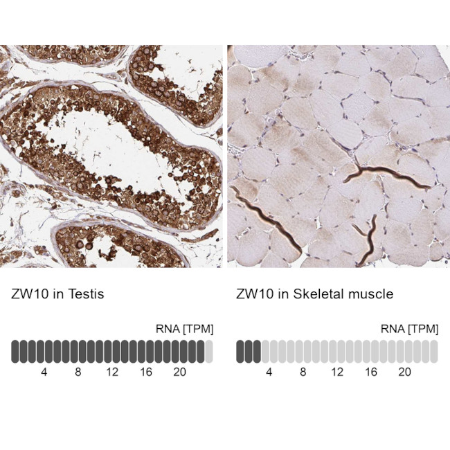 ZW10 Antibody in Immunohistochemistry (IHC)