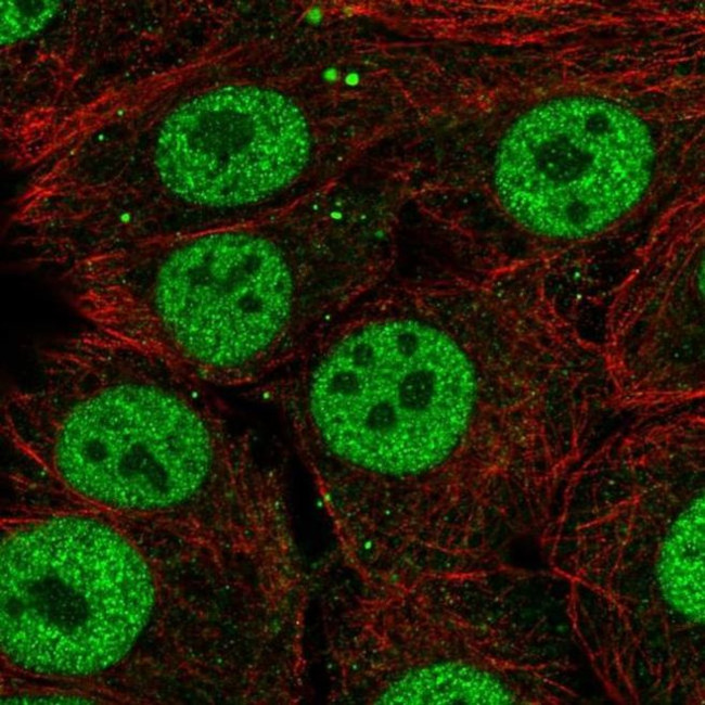 SYT10 Antibody in Immunocytochemistry (ICC/IF)