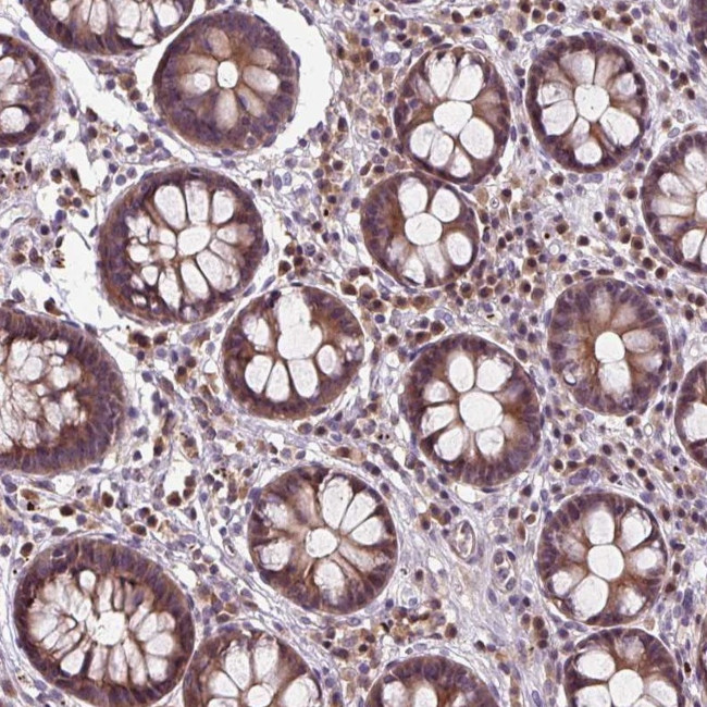 ZNF555 Antibody in Immunohistochemistry (Paraffin) (IHC (P))