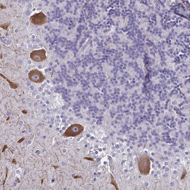CHD5 Antibody in Immunohistochemistry (Paraffin) (IHC (P))