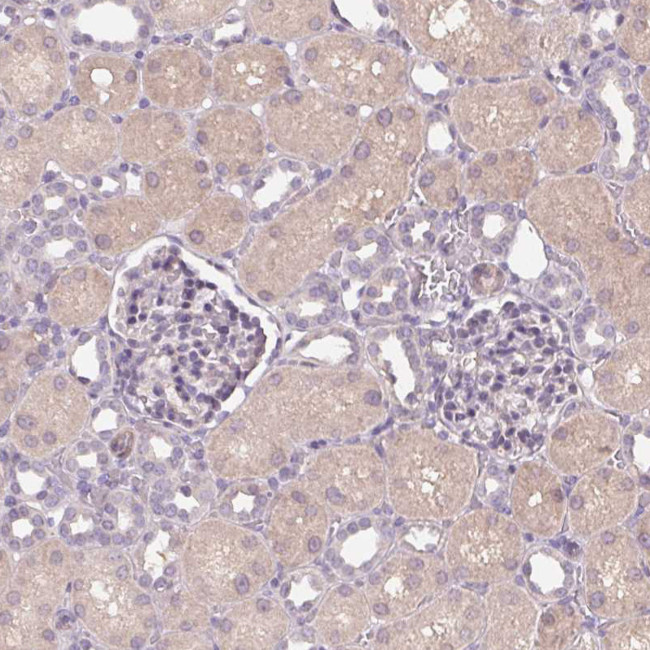HHLA2 Antibody in Immunohistochemistry (Paraffin) (IHC (P))
