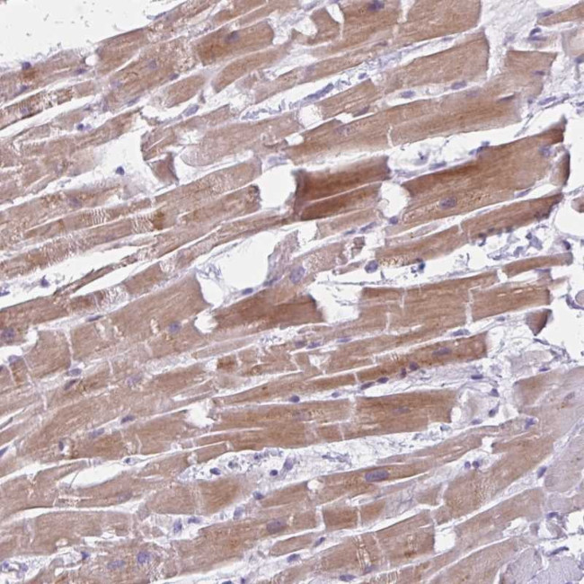 FAM153B Antibody in Immunohistochemistry (Paraffin) (IHC (P))