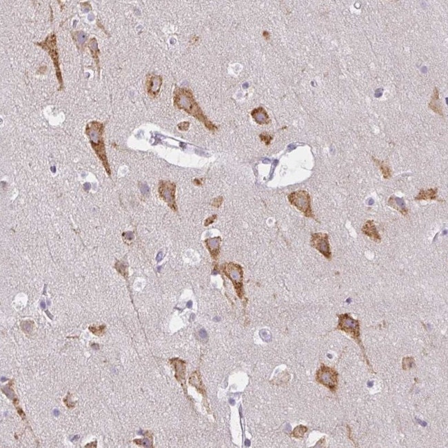 ZFYVE26 Antibody in Immunohistochemistry (Paraffin) (IHC (P))