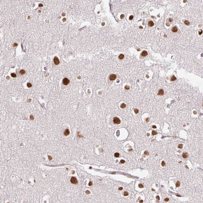 RIPPLY3 Antibody in Immunohistochemistry (Paraffin) (IHC (P))