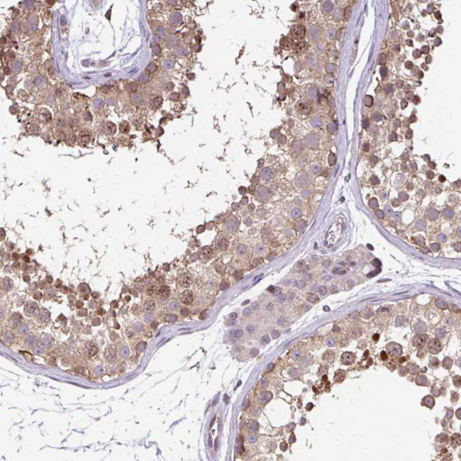 FIGNL1 Antibody in Immunohistochemistry (Paraffin) (IHC (P))