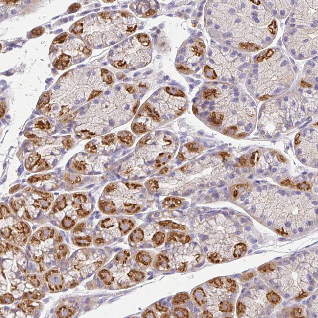 Epsin 3 Antibody in Immunohistochemistry (Paraffin) (IHC (P))