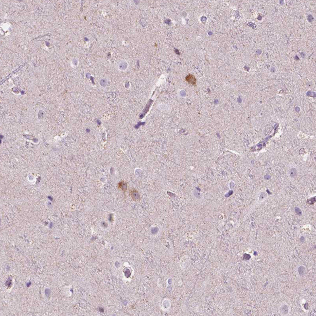 NOS1AP Antibody in Immunohistochemistry (Paraffin) (IHC (P))