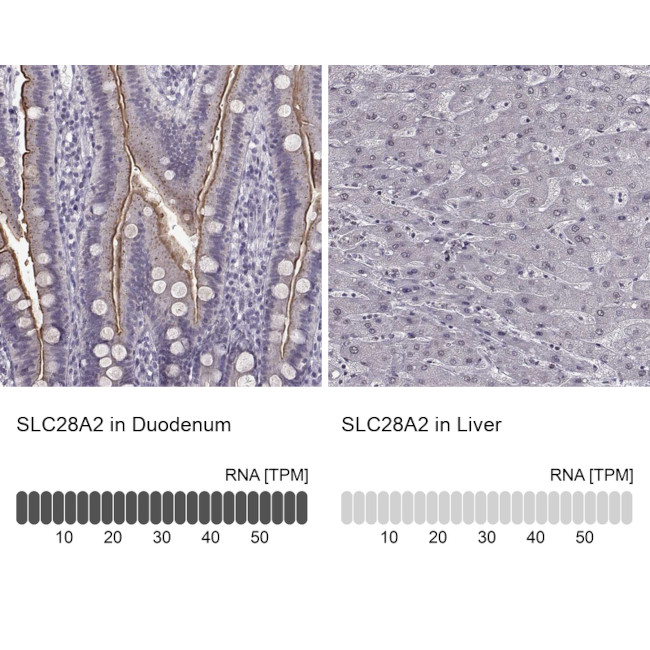 SLC28A2 Antibody