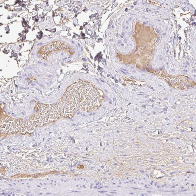 HOXC12 Antibody in Immunohistochemistry (Paraffin) (IHC (P))