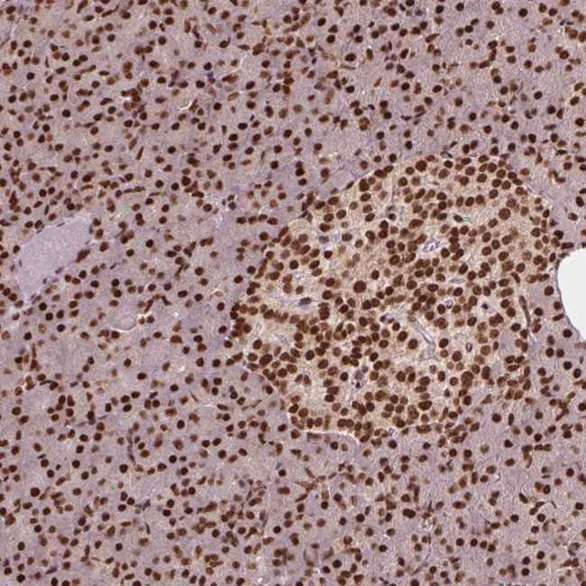 TTLL9 Antibody in Immunohistochemistry (Paraffin) (IHC (P))