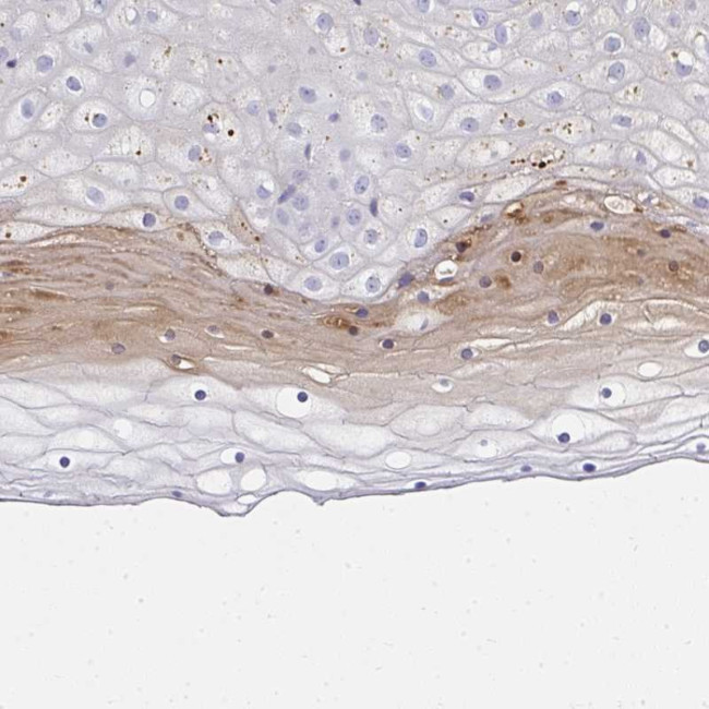 ZSWIM3 Antibody in Immunohistochemistry (Paraffin) (IHC (P))