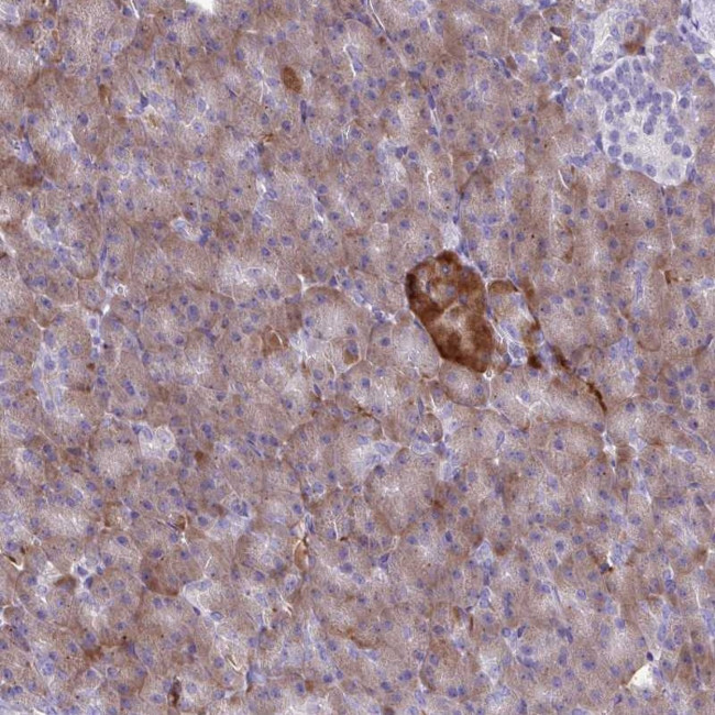 FAM86B1 Antibody in Immunohistochemistry (Paraffin) (IHC (P))