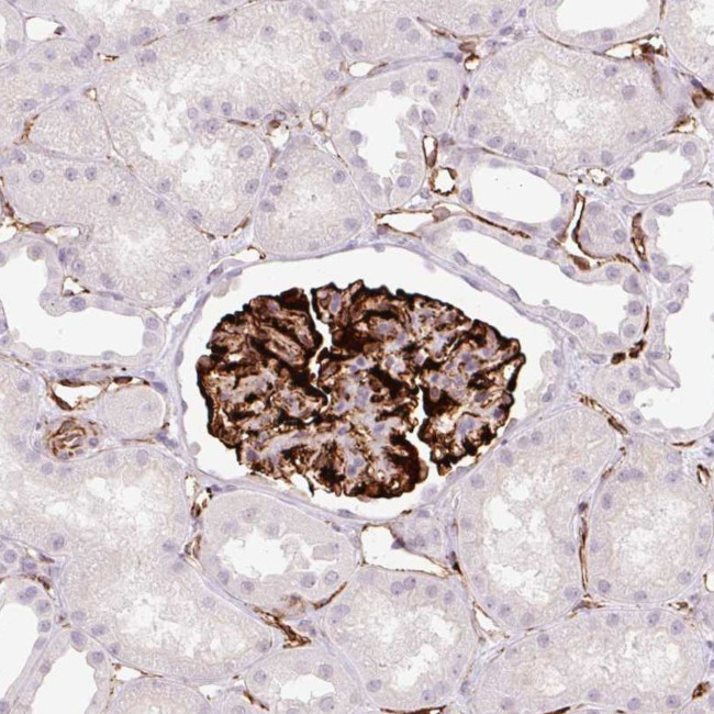 ZFYVE21 Antibody in Immunohistochemistry (Paraffin) (IHC (P))