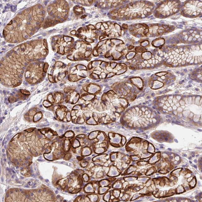 OR4K15 Antibody in Immunohistochemistry (Paraffin) (IHC (P))