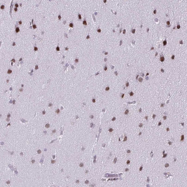 SS18 Antibody in Immunohistochemistry (IHC)