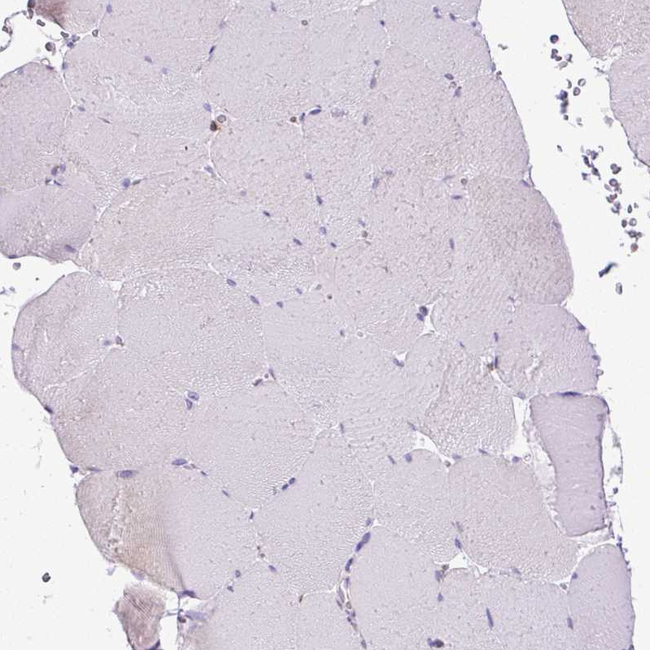 PLS1 Antibody in Immunohistochemistry (Paraffin) (IHC (P))