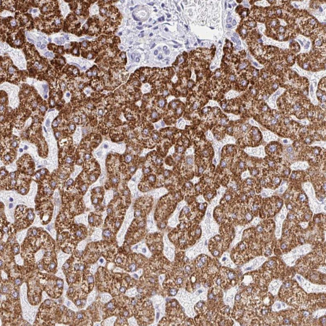 FAM214B Antibody in Immunohistochemistry (Paraffin) (IHC (P))