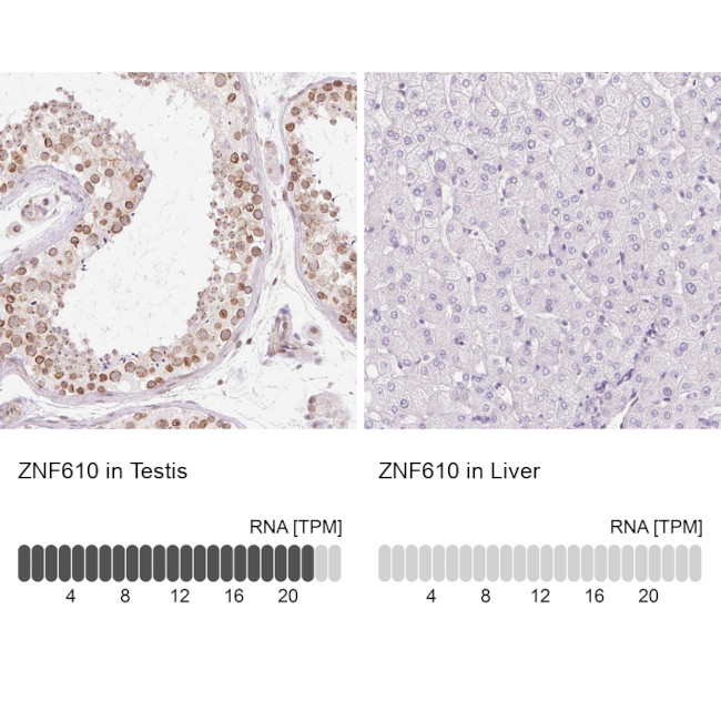 ZNF610 Antibody in Immunohistochemistry (IHC)