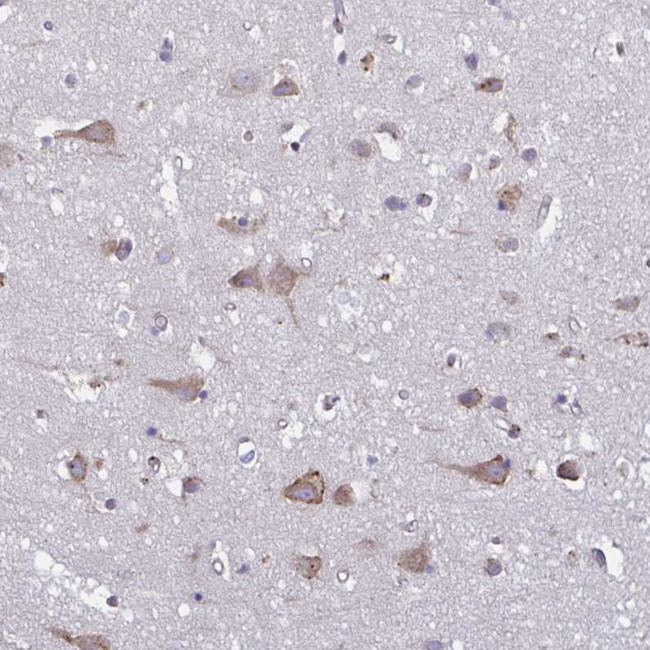 TMEM8C Antibody in Immunohistochemistry (IHC)