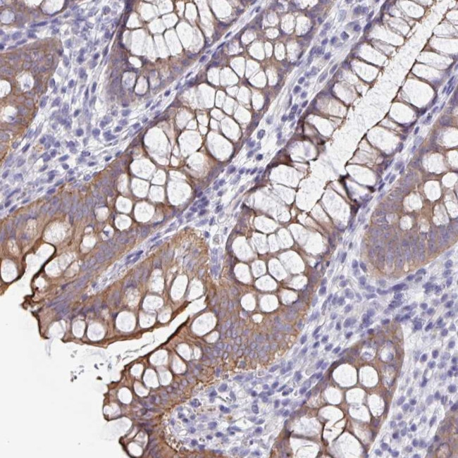 UNKL Antibody in Immunohistochemistry (Paraffin) (IHC (P))