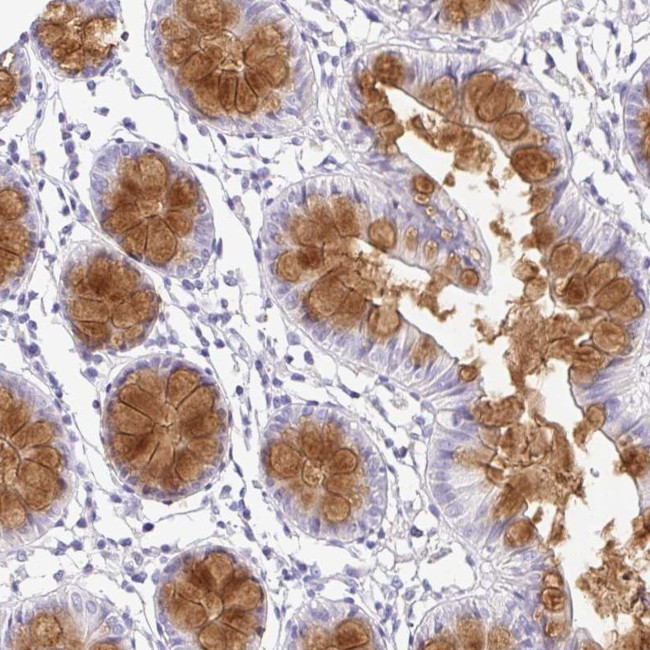 SERPINE3 Antibody in Immunohistochemistry (Paraffin) (IHC (P))