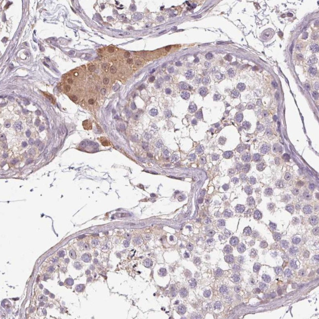 PRSS38 Antibody in Immunohistochemistry (Paraffin) (IHC (P))