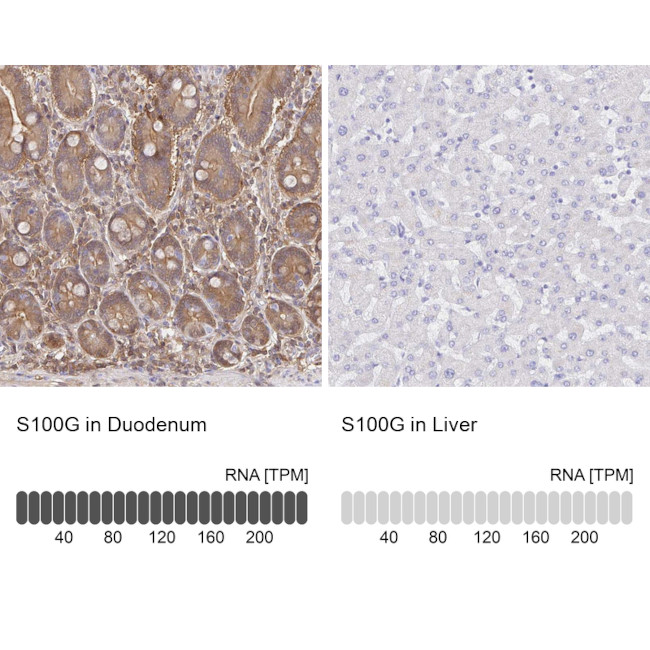 S100G Antibody in Immunohistochemistry (IHC)