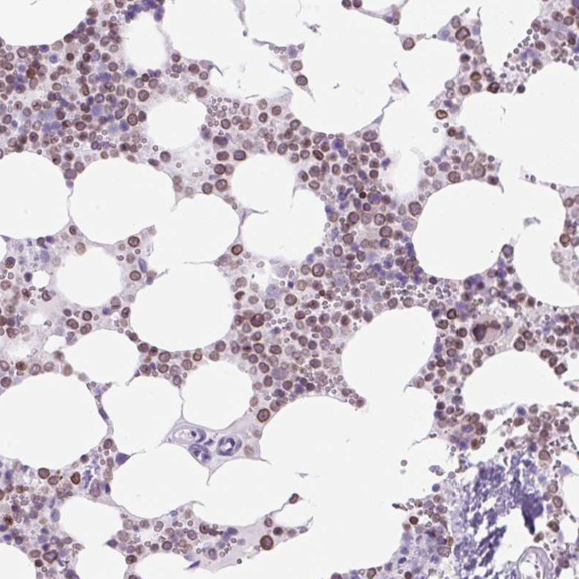 CD179a Antibody in Immunohistochemistry (Paraffin) (IHC (P))