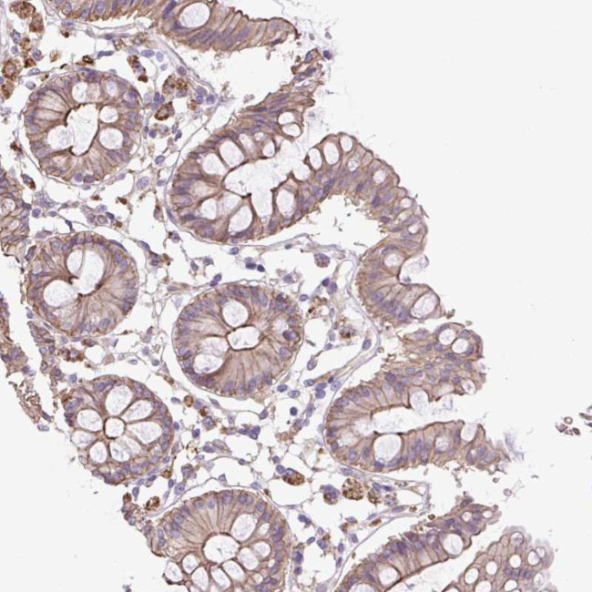 OR13D1 Antibody in Immunohistochemistry (Paraffin) (IHC (P))