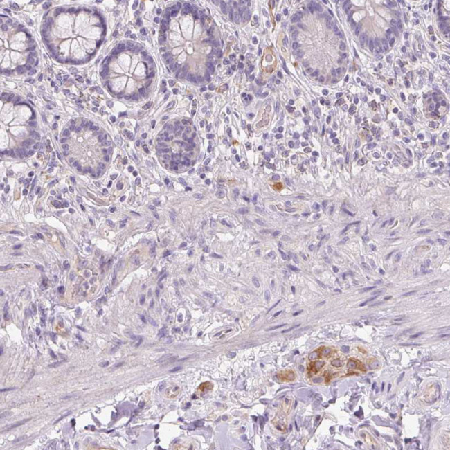 TMEM100 Antibody in Immunohistochemistry (Paraffin) (IHC (P))