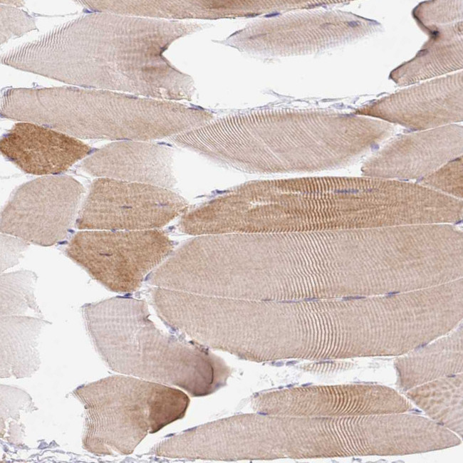 COX8A Antibody in Immunohistochemistry (Paraffin) (IHC (P))