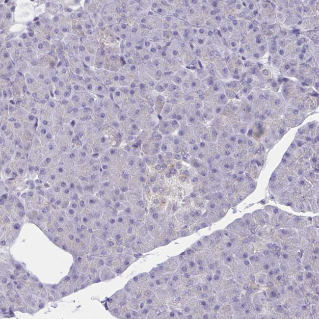 CRACC Antibody in Immunohistochemistry (Paraffin) (IHC (P))