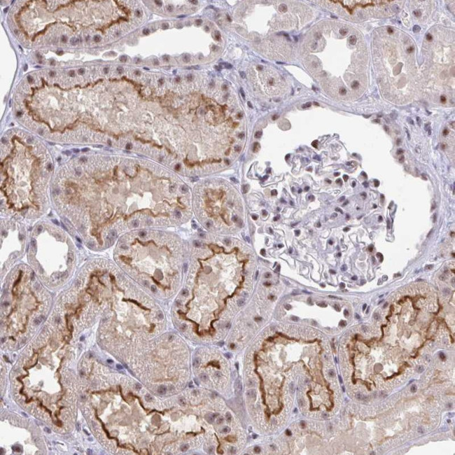 OR6K3 Antibody in Immunohistochemistry (Paraffin) (IHC (P))