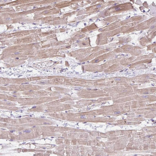 CDRT15 Antibody in Immunohistochemistry (Paraffin) (IHC (P))