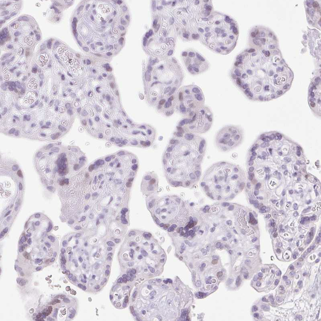 SPRR4 Antibody in Immunohistochemistry (Paraffin) (IHC (P))