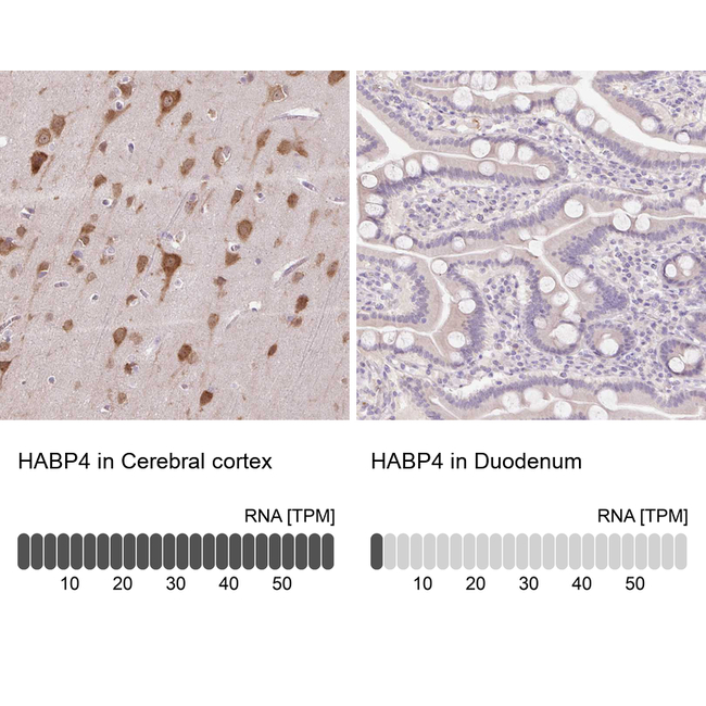 HABP4 Antibody in Immunohistochemistry (Paraffin) (IHC (P))
