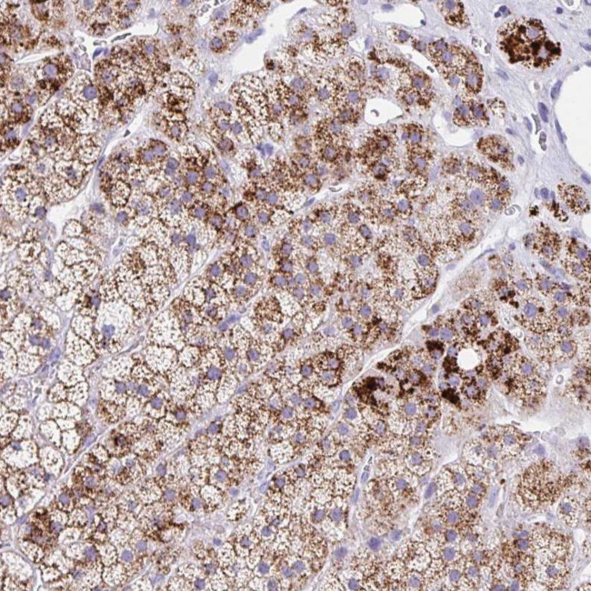 ANKRD9 Antibody in Immunohistochemistry (Paraffin) (IHC (P))