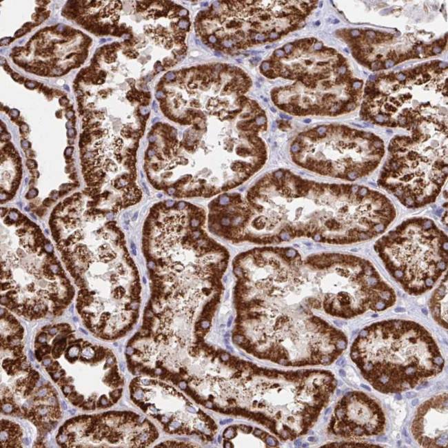 FAM160A2 Antibody in Immunohistochemistry (Paraffin) (IHC (P))
